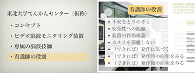 画像：てんかん診療とビデオ脳波モニタリング02