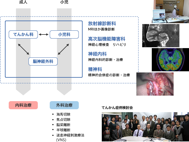 東北大学では複数の科が連携して包括的なてんかん診療を提供しています。