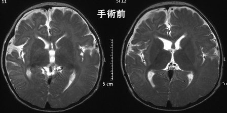 画像：手術前